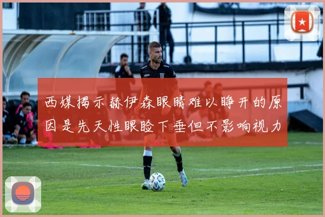 西媒揭示赫伊森眼睛难以睁开的原因是先天性眼睑下垂但不影响视力